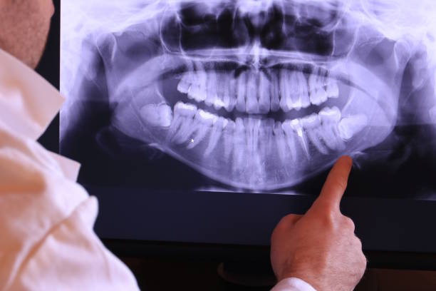 Best Knocked-Out Tooth Emergency  in Tryon, NC