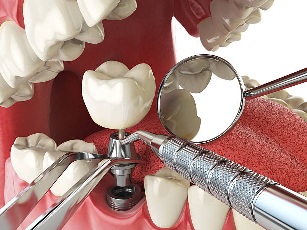 Best Broken Tooth Emergency  in Tryon, NC